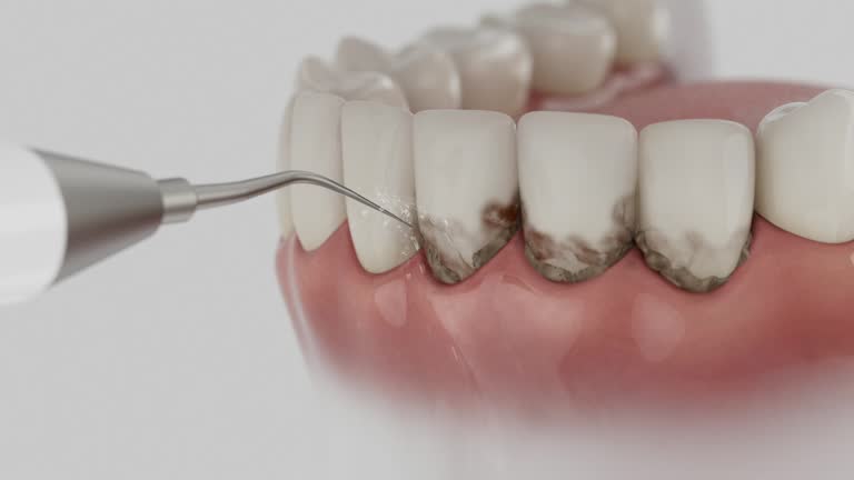 Reliable Emergency Dentist contractor in Nicollet, MN by Smile Center Dentistry